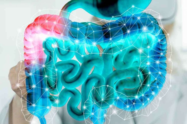 Understanding Irritable Bowel Syndrome (IBS) and Leaky Gut Syndrome