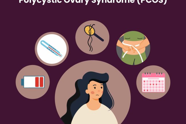 Getting to Know PCOS: Polycystic Ovary Syndrome (PCOS)