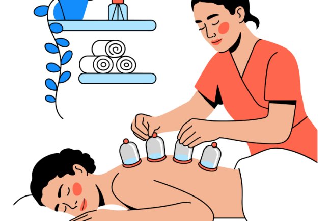 Health Benefits of Acupuncture for Natural Healing